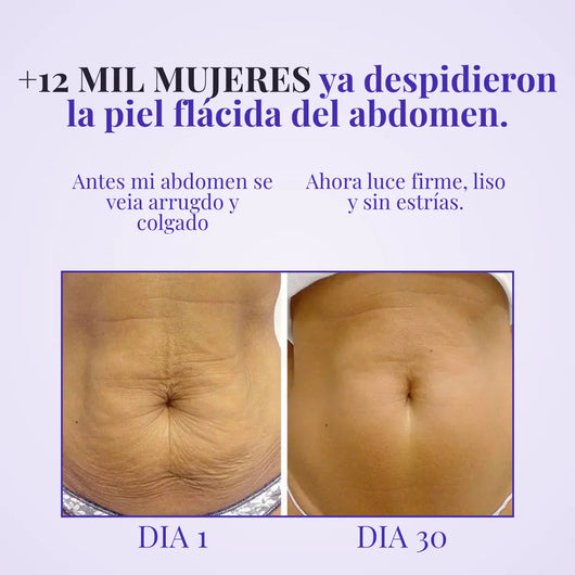 Crema Reactivadora de Colágeno Abdominal